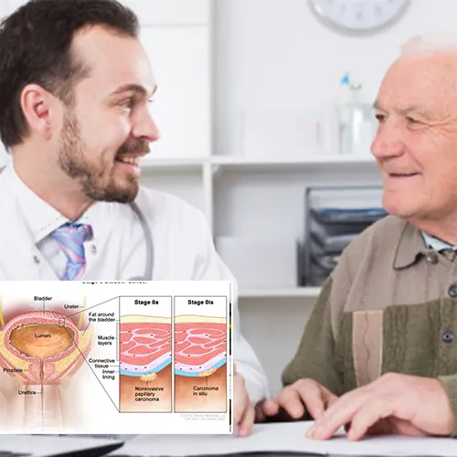 Maintaining Optimal Function of Your Penile Implant